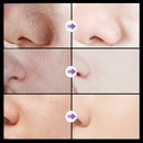 Anti-blackhead krém